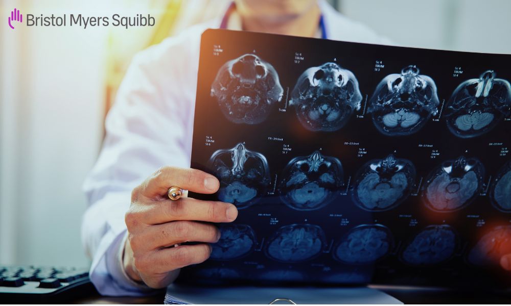 Bristol Myer Stock Gets a Bump on FDA Approval for Schizophrenia Drug: Is it Time to Buy BMY?